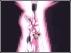 Letteralmente "Attacco Genocida", è probabilmente uno degli attacchi più devastanti di tutte le serie di Dragon Ball. Usato da Majin Buu per sterminare tutto il popolo della terra, egli alza il braccio sinistro e crea una fonte d'energia da cui partono infiniti raggi che salgono in aria per poi ricadere sulla Terra, colpendo a morte tutti gli individui.